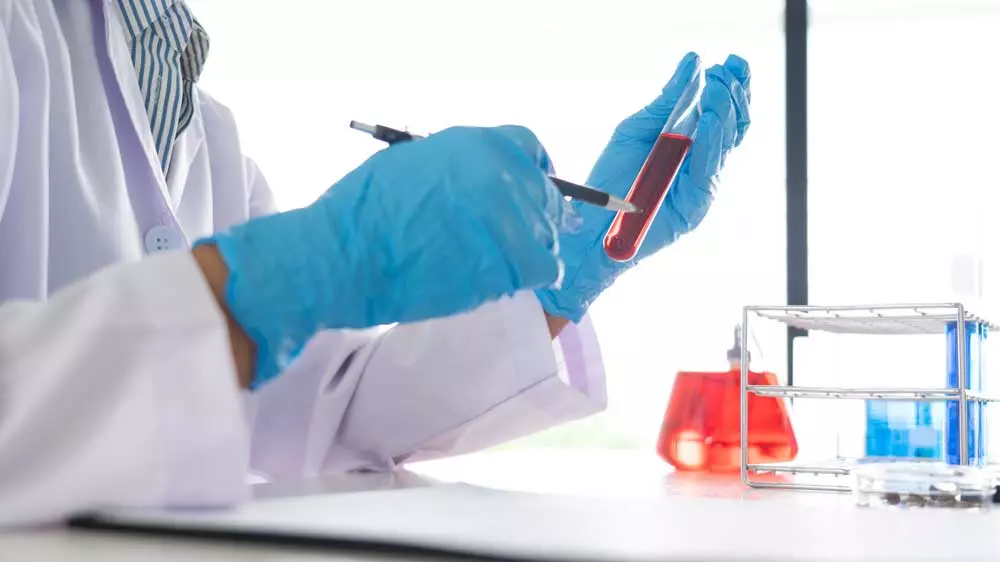 7 exámenes de laboratorio más importantes