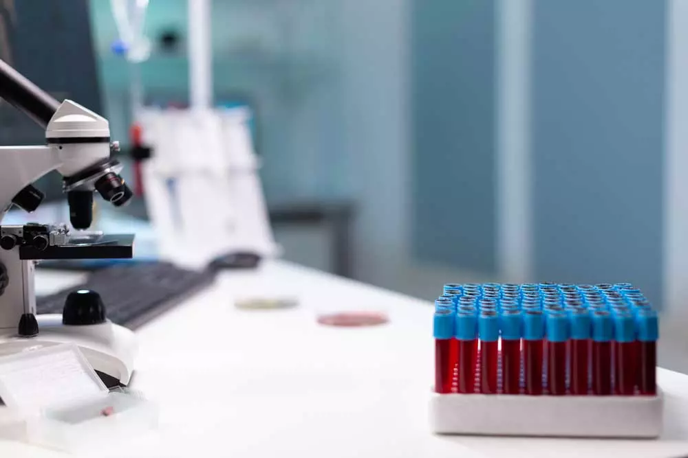 Exámenes importantes de un laboratorio clínico